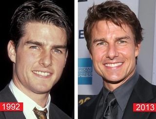Tom Cruise, cosmetic surgery
