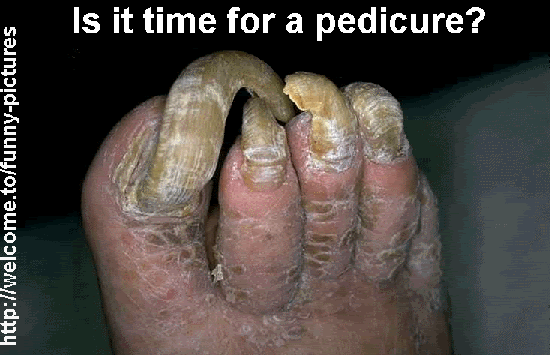 pedicure with grinder photo: pedicure frickinnasty.gif